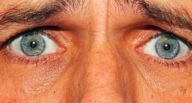 Des irritations des yeux sont possibles lorsque le taux de particules fines augmente dans l'atmosphère Tarbes7.fr